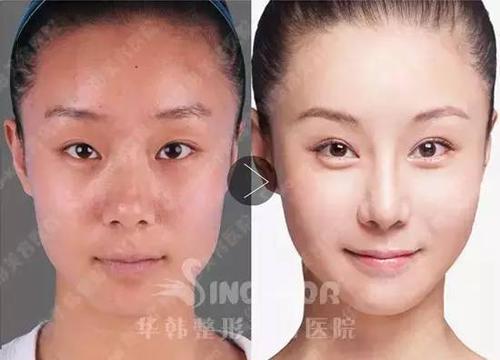 结果106&deg;被评为人类最美鼻形,这些公认的美人
